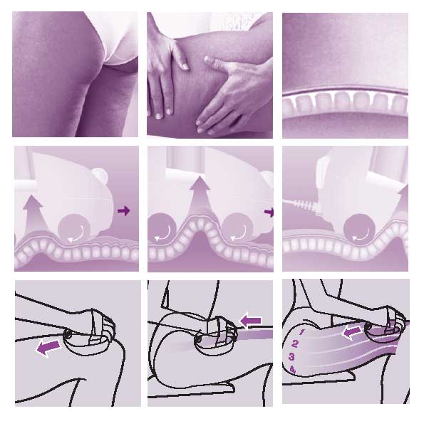 Celulit eliminator - Philips HP 5215 Cellese - dodatni pogled