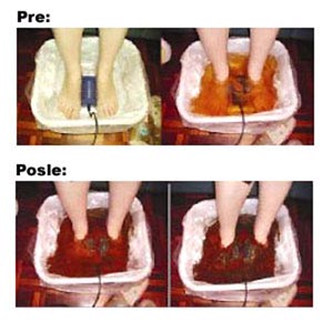  Harox Aqua Detox Foot Spa HX-T9 - dodatni pogled