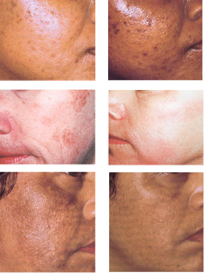 Pigment Balans expert krem 50ml - dodatni pogled