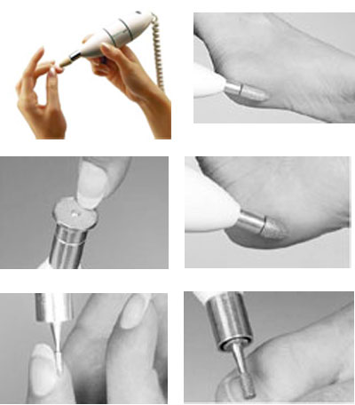 Medisana set za pedikir-manikir MEDISTYLE-S - dodatni pogled