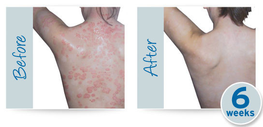 Zeoderm krema za problematična kožna oboljenja 50ml - dodatni pogled