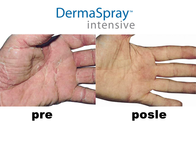Derma spray intensive 50 ml 4761 - dodatni pogled