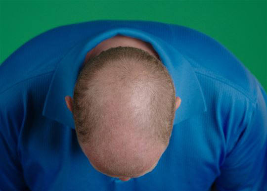 Hair grow max - losion za rast kose - dodatni pogled