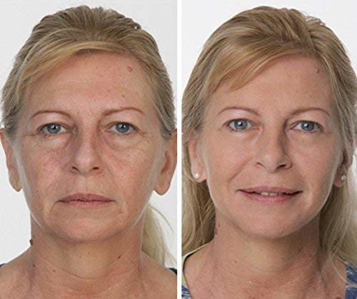 Venoia antiage serum - dodatni pogled