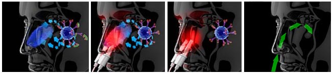 MEDINOSE - aparat protiv alergija i kijavice - detalj