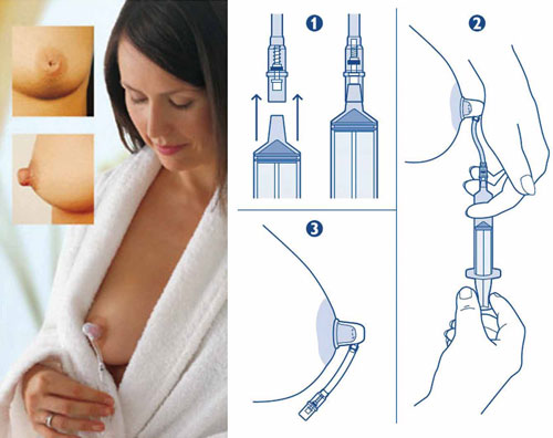 Avent Pumpica za izvlačenje bradavica Niplette - detalj