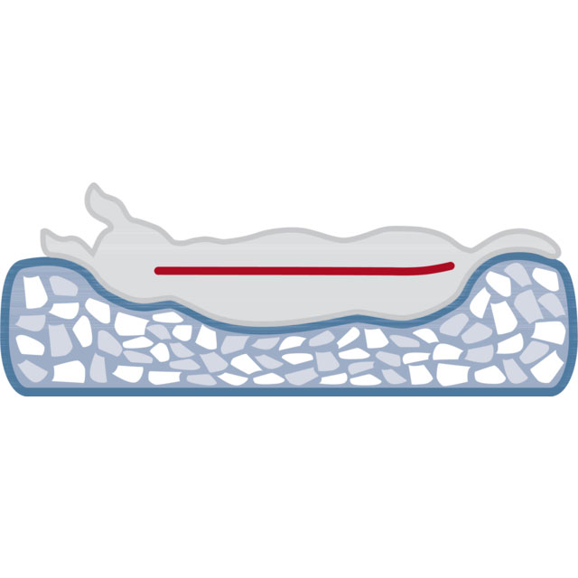 Trixie Ortopedski krevet za pse Tonio Vital Petrol 60cm 36500 - detalj