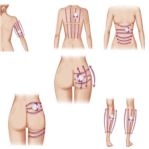 Anticelulit masažer Silkn Silhouette SILH1PE3001 H2101/H2102 - detalj