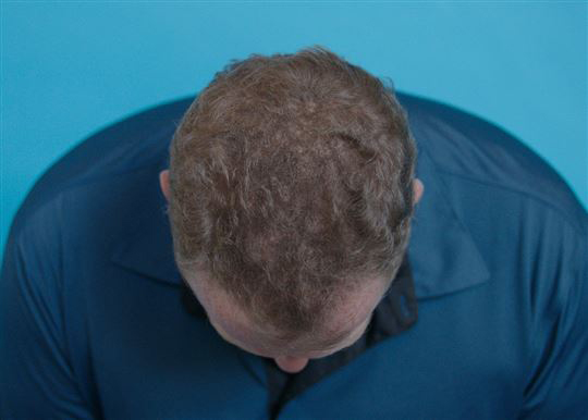 Hair grow max - losion za rast kose - detalj