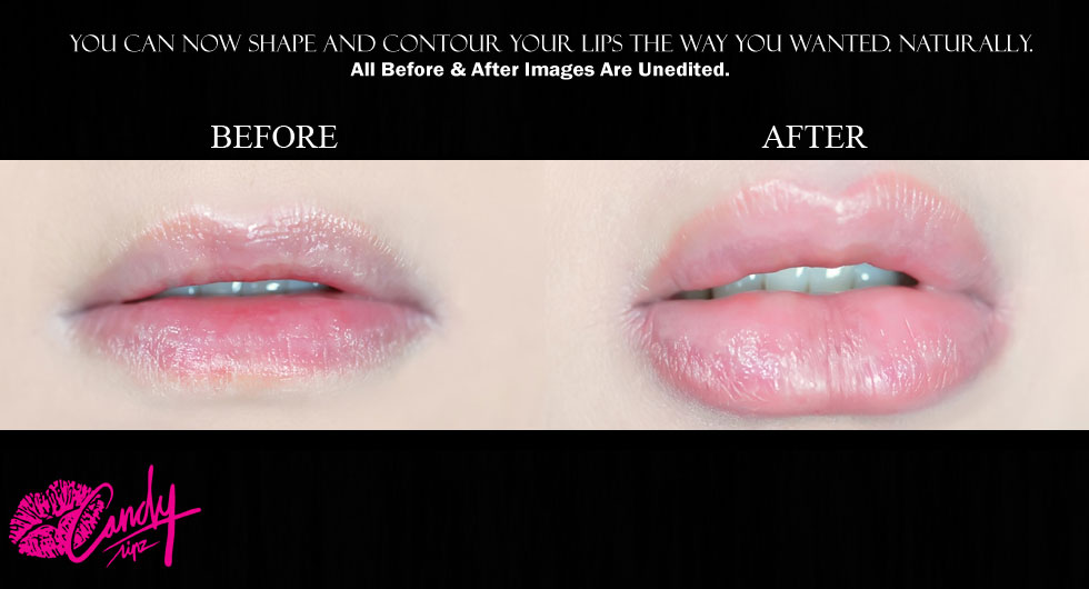 Candy lipz za povećanje usana crvena - detalj