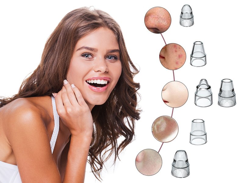 Aparat za čišćenje pora i uklanjanje mitisera BEPER P302VIS001 - pogled 4