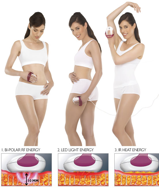 Anticelulit masažer Silkn Silhouette SILH1PE3001 H2101/H2102 - pogled 4