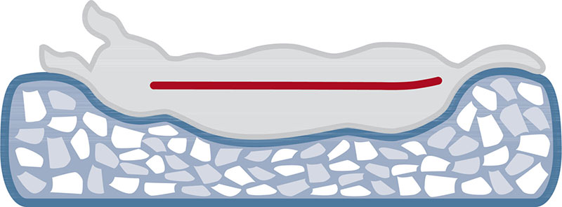 Otropedski krevet za pse 60cm Calito Vital blue Trixie 37354 - pogled 4