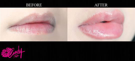 Candy lipz za povećanje usana zelena - pogled 4