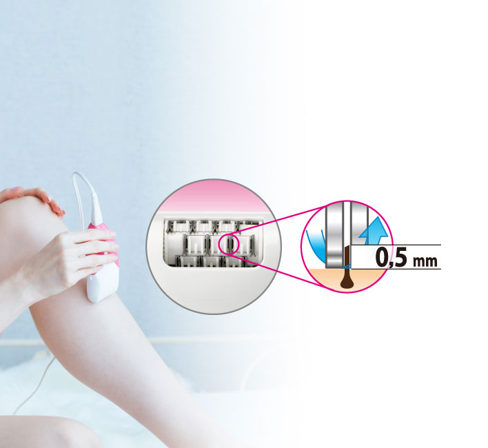 Panasonic epilator ES-WS14 P503 - pogled 4