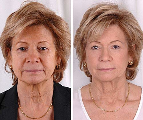 Venoia antiage krema i serum - pogled 4