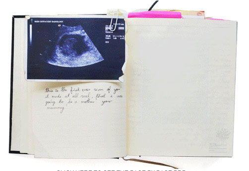 SuckUK Priča Mog Života MYLIFESTORY1 - pogled 5